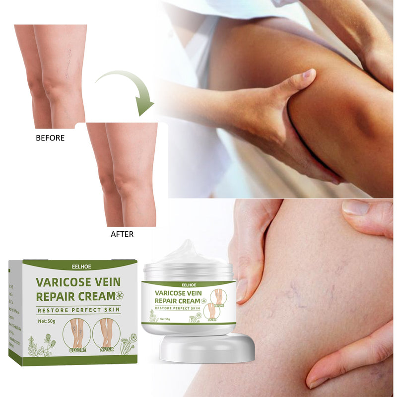 EELHOE Leg Repair Cream Relieves Leg Discomfort Massage Leg Repair Cream For Raised Veins