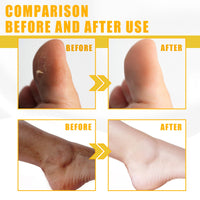 Yellow Exfoliating Oil, Brightening Skin, Moisturizing Whitening Beautify Skin And Body Exfoliating Oil