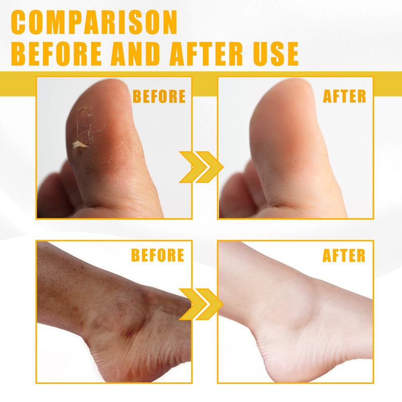 Yellow Exfoliating Oil, Brightening Skin, Moisturizing Whitening Beautify Skin And Body Exfoliating Oil