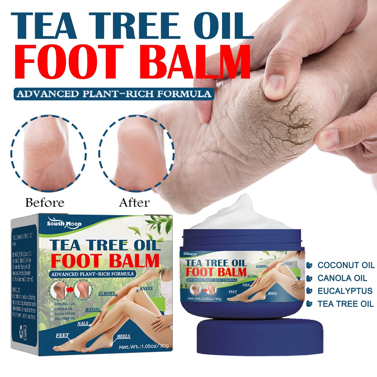 South Moon Urea Hand And Foot Cream, Anti-Crack Peeling Repair Skin Crack Dry Moisturizing Skin Soothes Skin