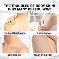 Brightening And Moisturizing Body Lotion, Repair Chicken Skin, Prevent Dry, Tender And Smooth Skin, Whitening And Beautifying Skin