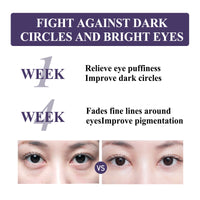Anti-Wrinkle Firming Eye Cream Lightens Dark Circles And Fine Lines Under Eyes, Tightens Skin And Lifts Anti-Wrinkle Eyes