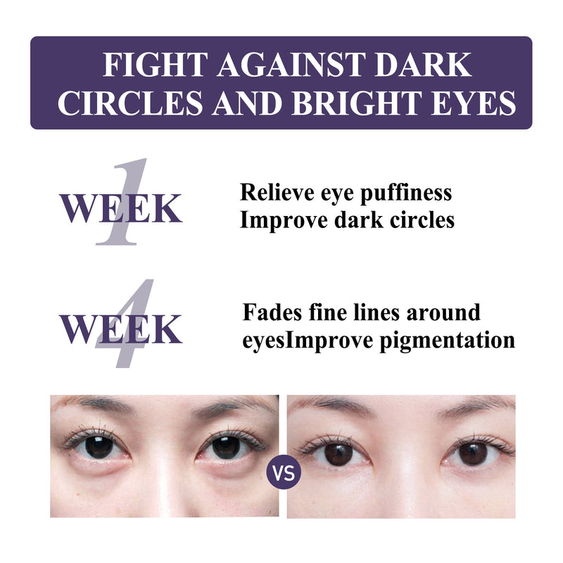 Anti-Wrinkle Firming Eye Cream Lightens Dark Circles And Fine Lines Under Eyes, Tightens Skin And Lifts Anti-Wrinkle Eyes