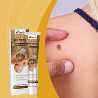 Ximonth Bee Venom Keyo Ointment, Gently Cleans Body Skin And Moisturizes Skin Moles With Bee Venom Essence