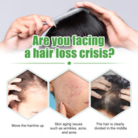 Castor Oil Dense Hair Solution, Moisturizes And Protects Hair Loss Dense And Black Hair Castor Oil Hair Care Essential Oil
