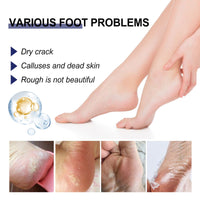 Cracked Heel Ointment, Repair Heel Calluses And Foot Moisturizing Anti-Cracking Peeling Care