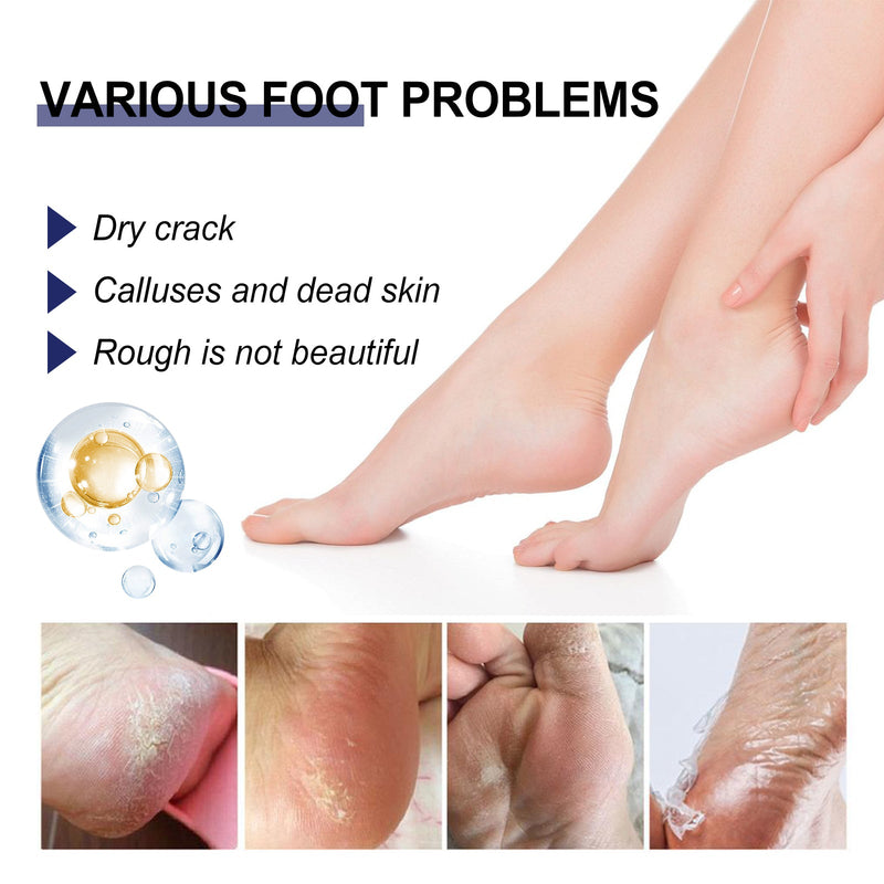 Cracked Heel Ointment, Repair Heel Calluses And Foot Moisturizing Anti-Cracking Peeling Care