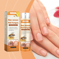 Houkea Bee Venom Nail Care Spray Foot Nail Cleaning, Moisturizing And Brightening Nail Care Spray