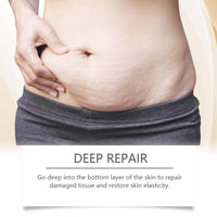 Ouhoe Skin Treatment Post-Natal Body Skin Repair Oil Moisturizing And Moisturizing Oil