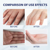 Aloe Vera Care Gel, Hydrating And Refreshing Moisturizing Cream Prevents Dryness And Cracks To Repair Hand Skin