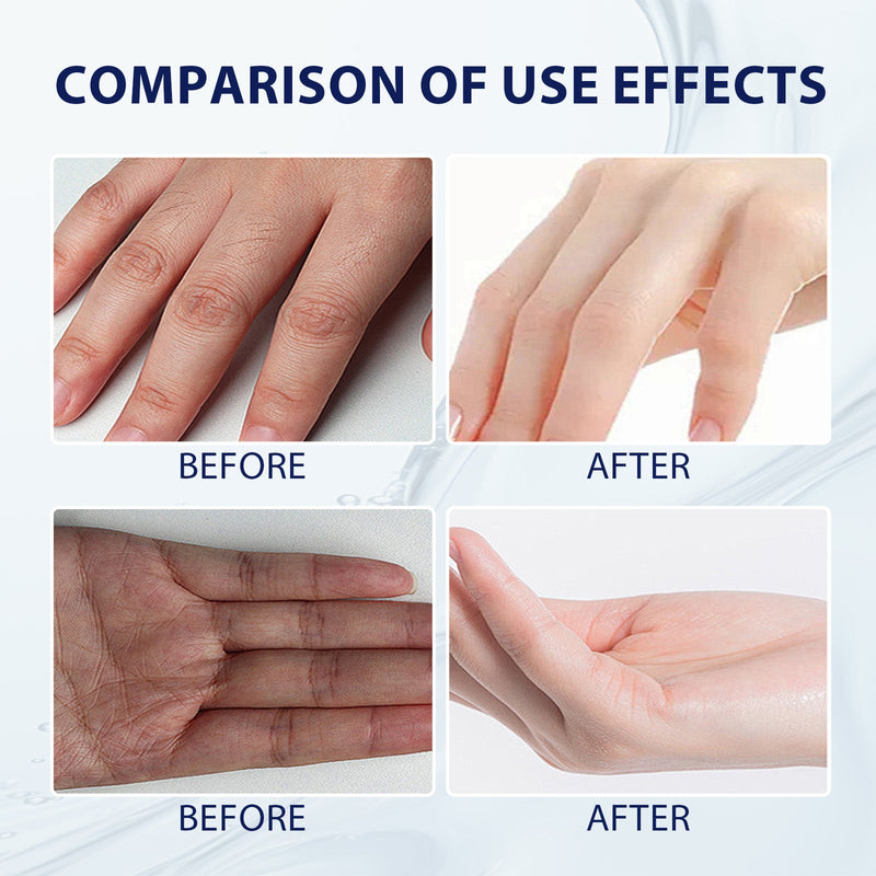 Aloe Vera Care Gel, Hydrating And Refreshing Moisturizing Cream Prevents Dryness And Cracks To Repair Hand Skin