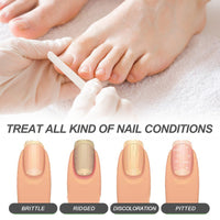 Nails Repairing Serum, Repair Hands And Feet Gray Nails Soft Nail Shine Moisturizing Nail Care