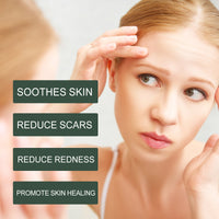 Pure Calendula Handcrafted Body Oil, Reduce Scar Skin Redness Moisturizing Smooth Firming Care