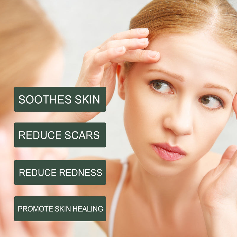 Pure Calendula Handcrafted Body Oil, Reduce Scar Skin Redness Moisturizing Smooth Firming Care