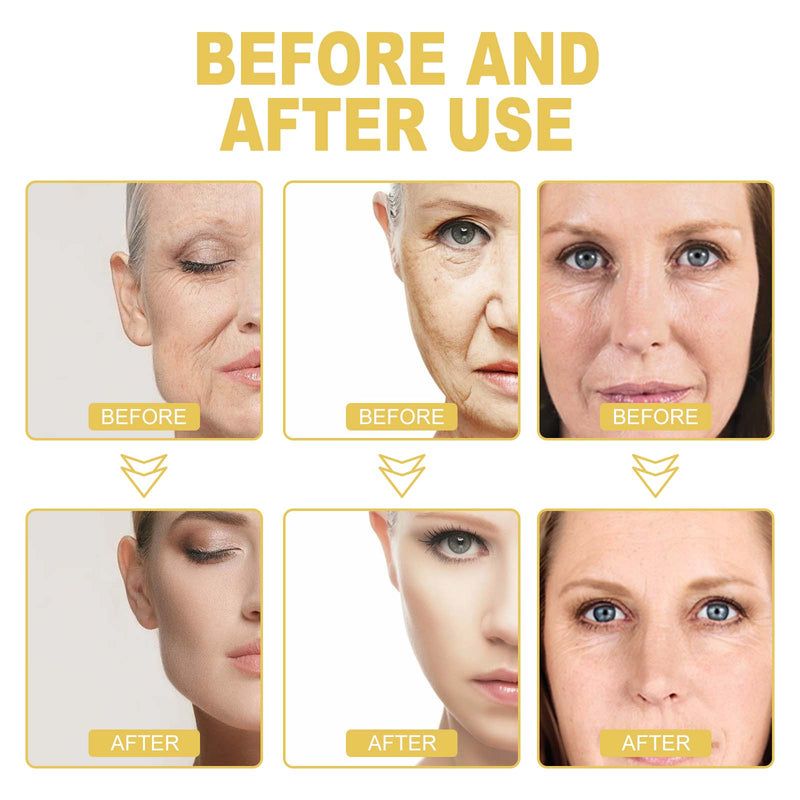 Mercy Face Serum, Firming Facial Skin Lighten Fine Lines Hydrating Essence