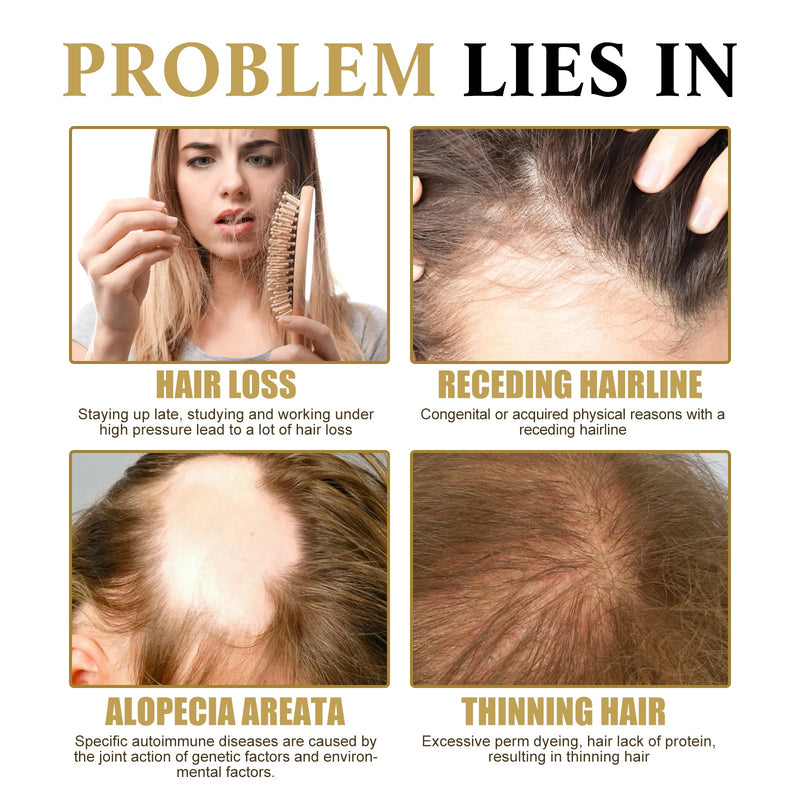West&Month Hair Boost Darken Strengthen Essence, Scalp Massage Moisturizing Hair Roots Thick Smooth Hair Care Ball