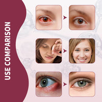 Eye Swelling Soothing Serum, Relieve Redness And Swelling Around The Eyes Moisturizing Essence