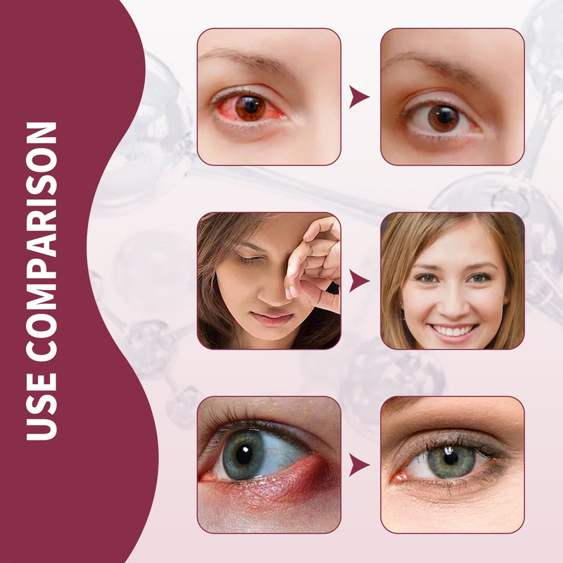 Eye Swelling Soothing Serum, Relieve Redness And Swelling Around The Eyes Moisturizing Essence