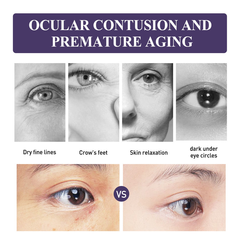 Anti-Wrinkle Firming Eye Cream Lightens Dark Circles And Fine Lines Under Eyes, Tightens Skin And Lifts Anti-Wrinkle Eyes