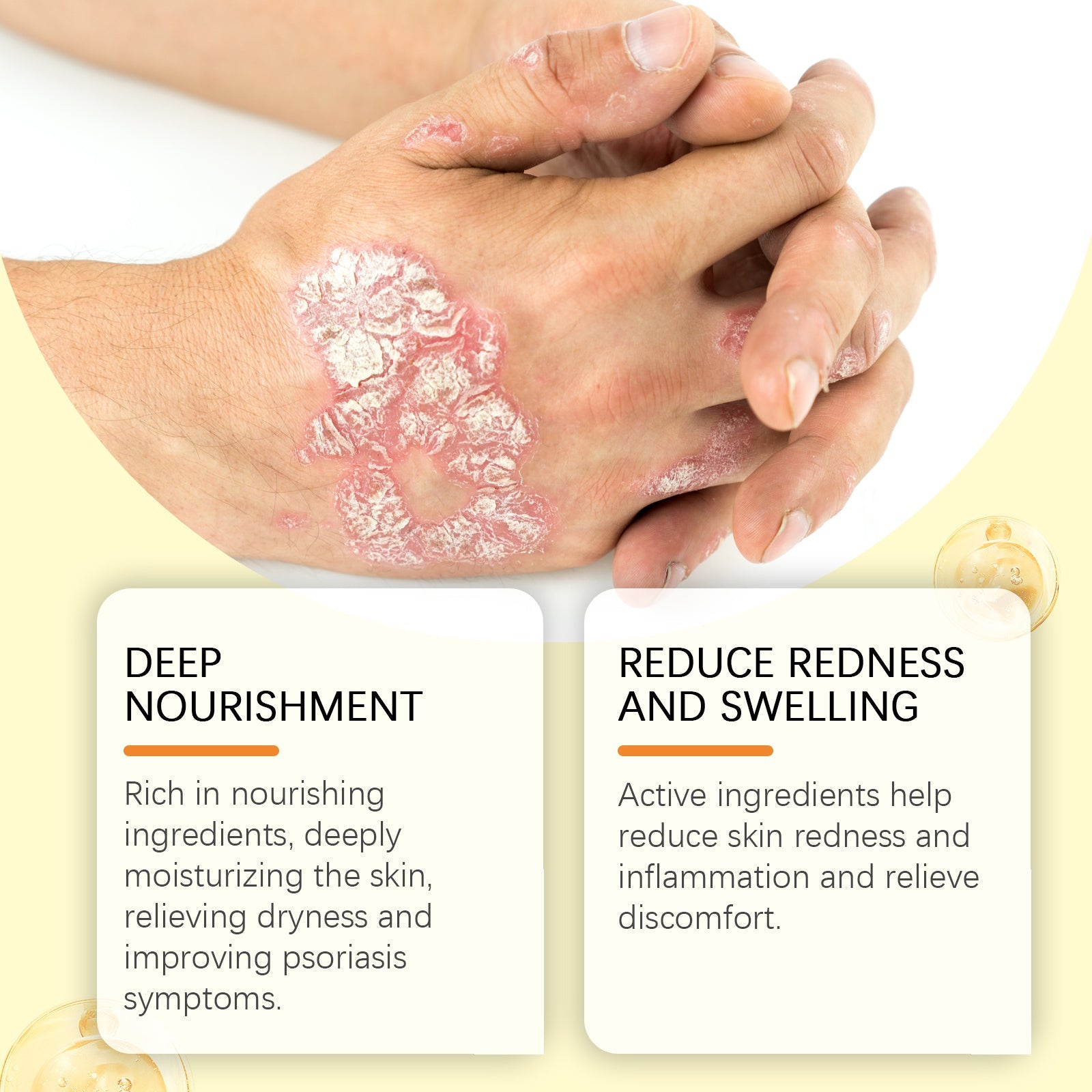 Skin Repair Spray, Nourishes Smooth Skin And Moisturizes Body, Hands And Feet Skin Care Spray