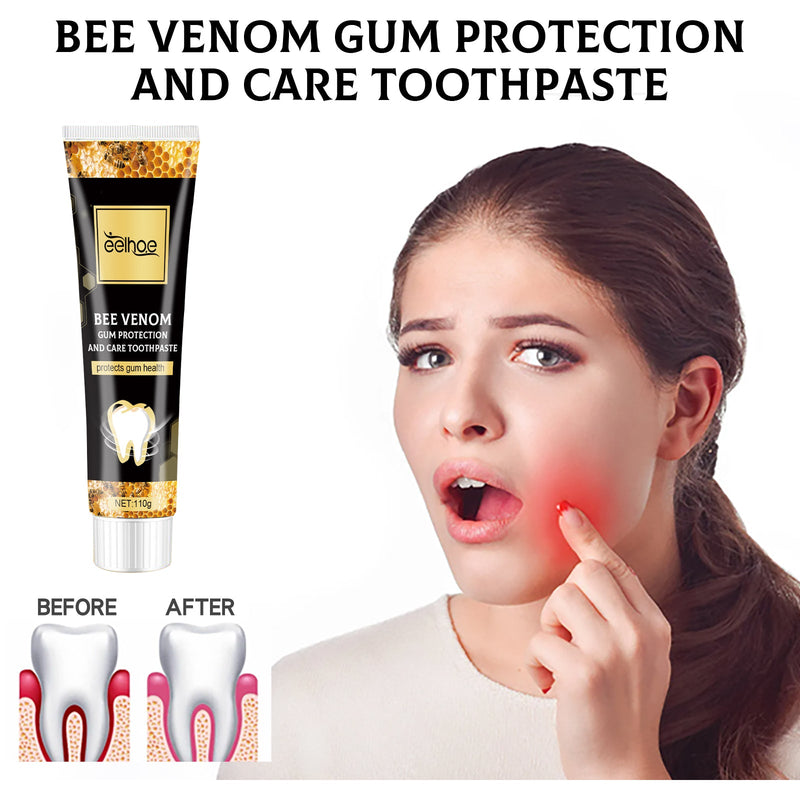 EELHOE Bee Venom Gingival Toothpaste, Cleaning Stains Breath Fresh Whitening Toothpaste