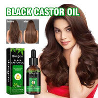 Black Castor Oil,Nourish Hair Prevent Moisture Scalp Solid Hair Strong Hair Black Castor Oil