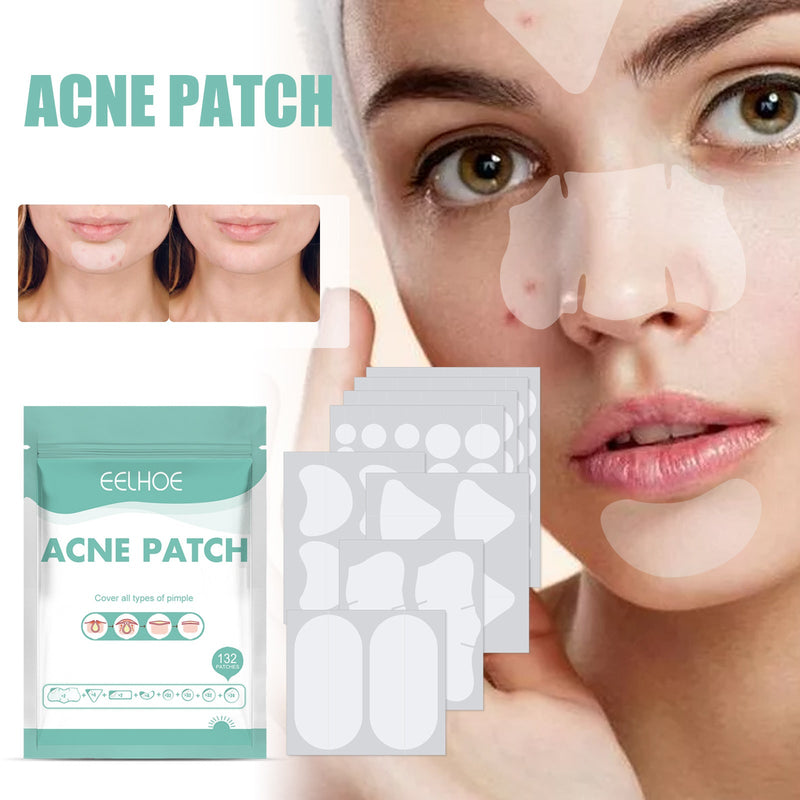 EELHOE Acne Patch Mild Non-Irritating Facial Pores Skin Cleansing Comfort Patch