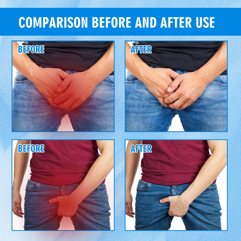 Men's Skin Care Cream For Inner Thigh Itching Relief Refreshing And Gentle Skin Cream