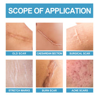 Scar Repair Serum Lightens Post-Pregnancy Scar Repair And Smoothes Body Skin