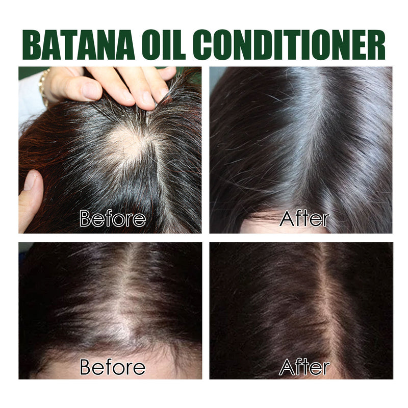 Eelhoe Batana Oil Conditioner Repair Damaged Hair Hydrating And Smoothing Hair Conditioner