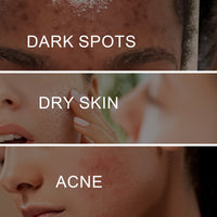Brightening Cream, Lightening Dark Spots, Spot Repair Rough, Brightening Complexion And Improving Dullness Beauty Cream
