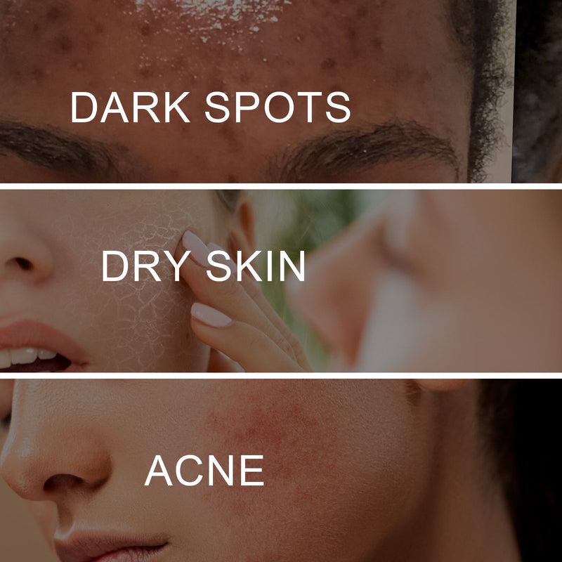 Brightening Cream, Lightening Dark Spots, Spot Repair Rough, Brightening Complexion And Improving Dullness Beauty Cream