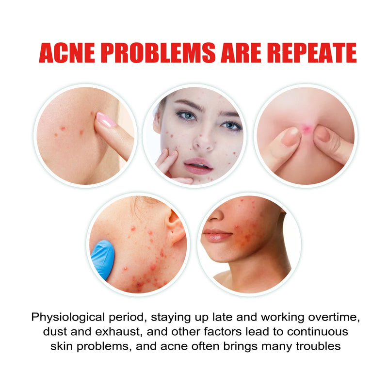 Cloud Acne Patch, Invisible Blemish Patch Gently Repair Acne Muscle To Reduce Acne Marks