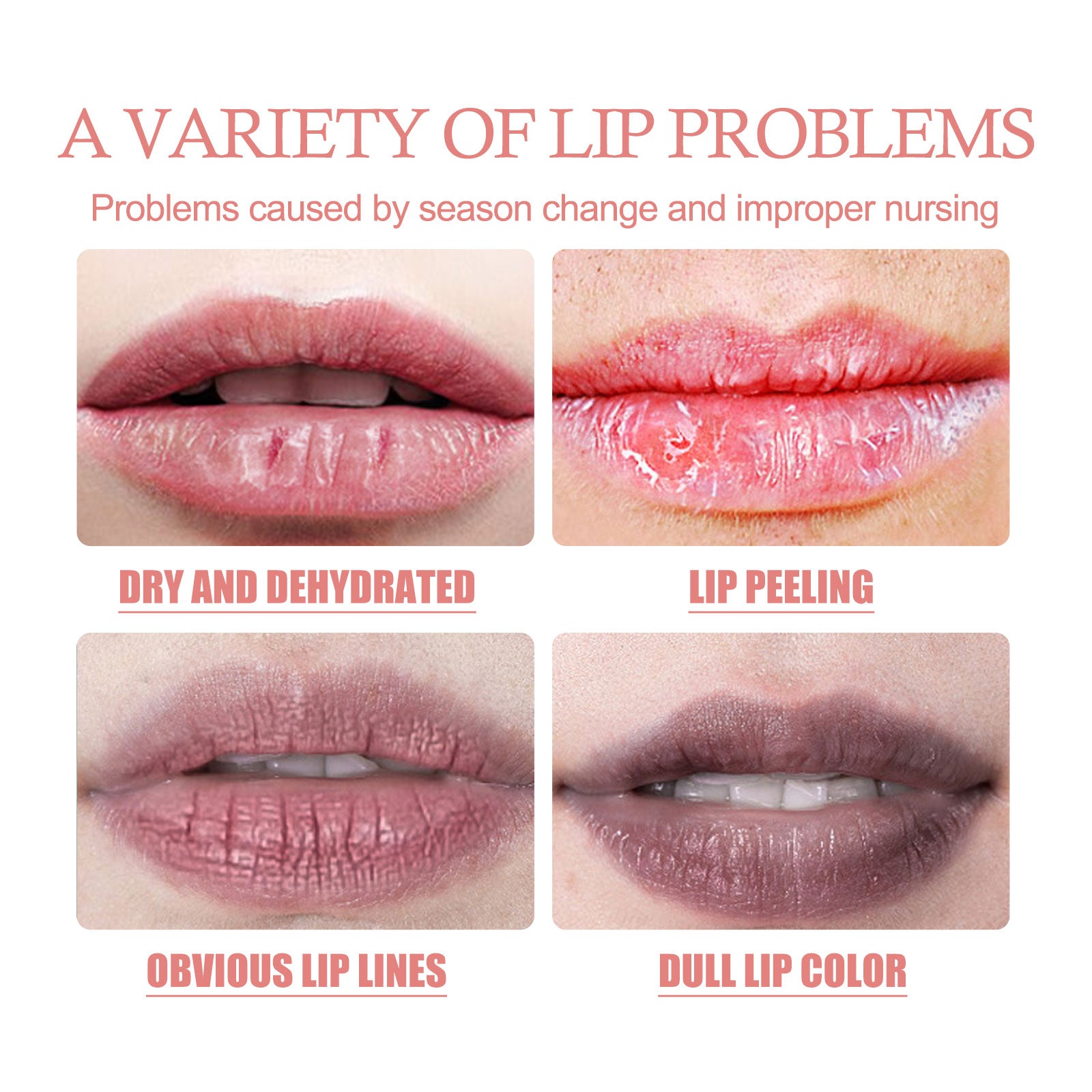 Exfoliates Dead Skin Bubble Lip Mask, Lightening Lip Lines Softening Horny Skin Moisturizing And Preventing Dry Cracking Lip Mask