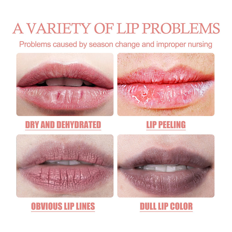 Exfoliates Dead Skin Bubble Lip Mask, Lightening Lip Lines Softening Horny Skin Moisturizing And Preventing Dry Cracking Lip Mask