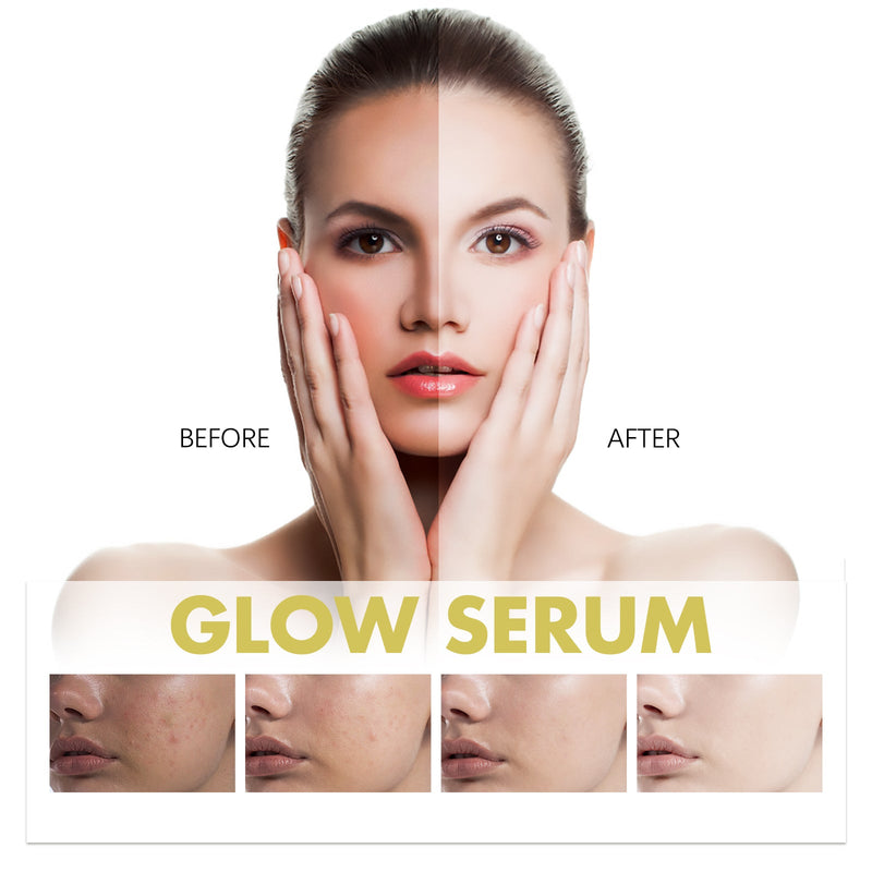 Hoygi Glow Serum - Moisturizing & Whitening, Reduces Spots & Fine Lines