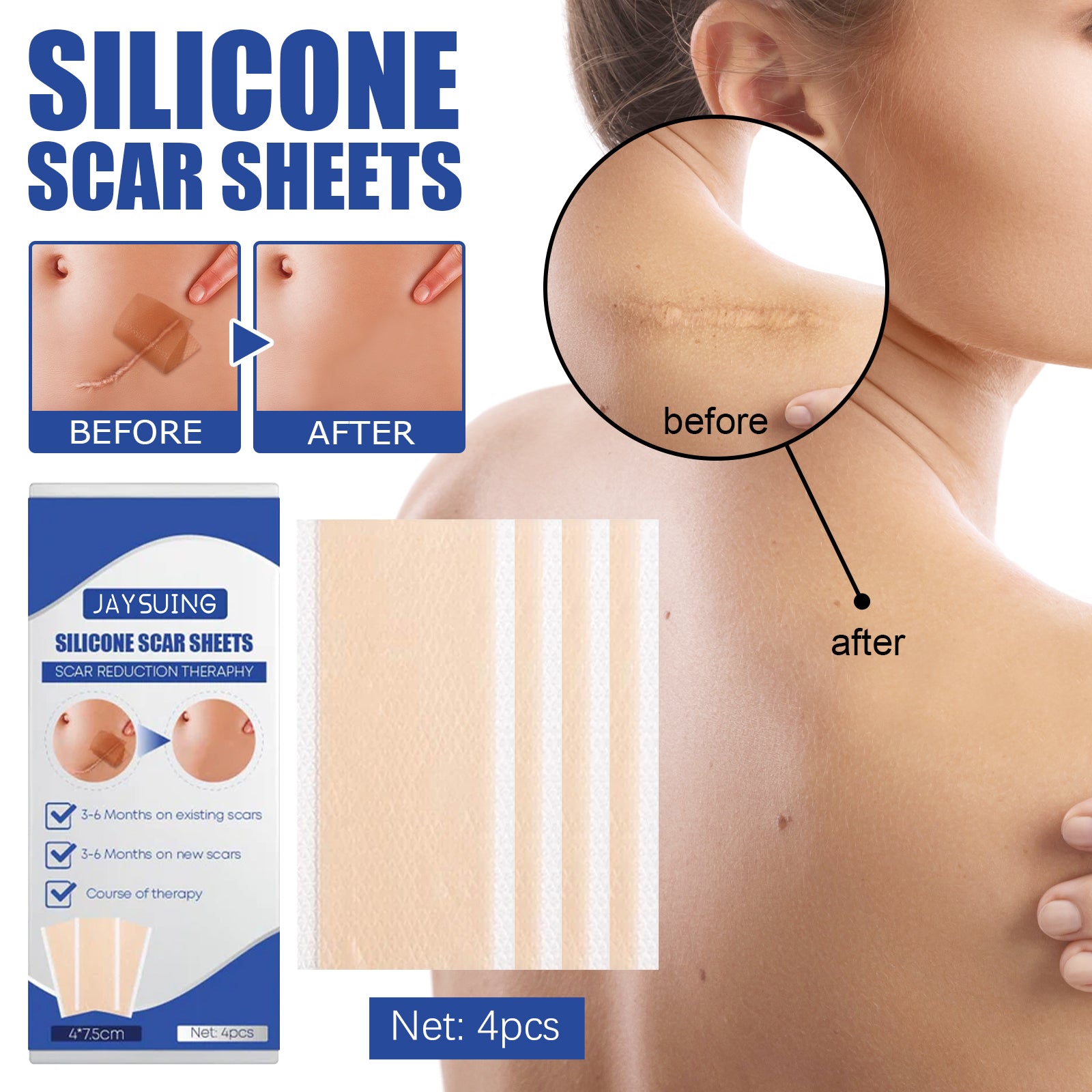 Scar Care Silicone Tape Skin Wound Scar Care Smooth Skin Body Care Patch