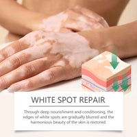 Body Care Cream, Relieve Itching And Swelling Of Hands And Feet Skin Moisturizing Skin Care Cream