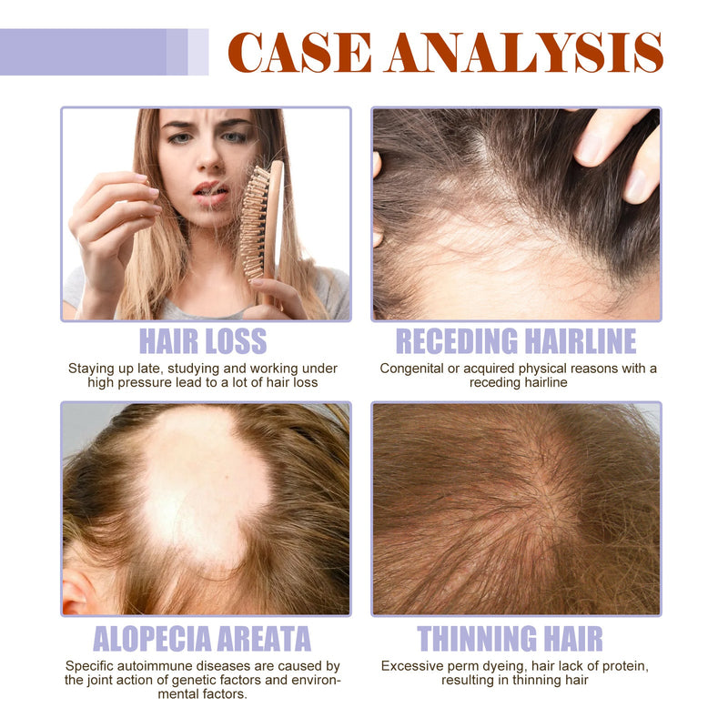 Dense Hair Supplement, Moisturizes Hair Roots, Strengthens Hair, Softens Hair And Prevents Hair Loss