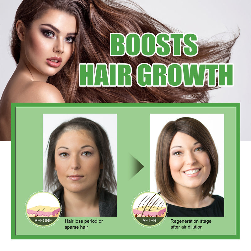 Castor Oil Dense Hair Solution, Moisturizes And Protects Hair Loss Dense And Black Hair Castor Oil Hair Care Essential Oil