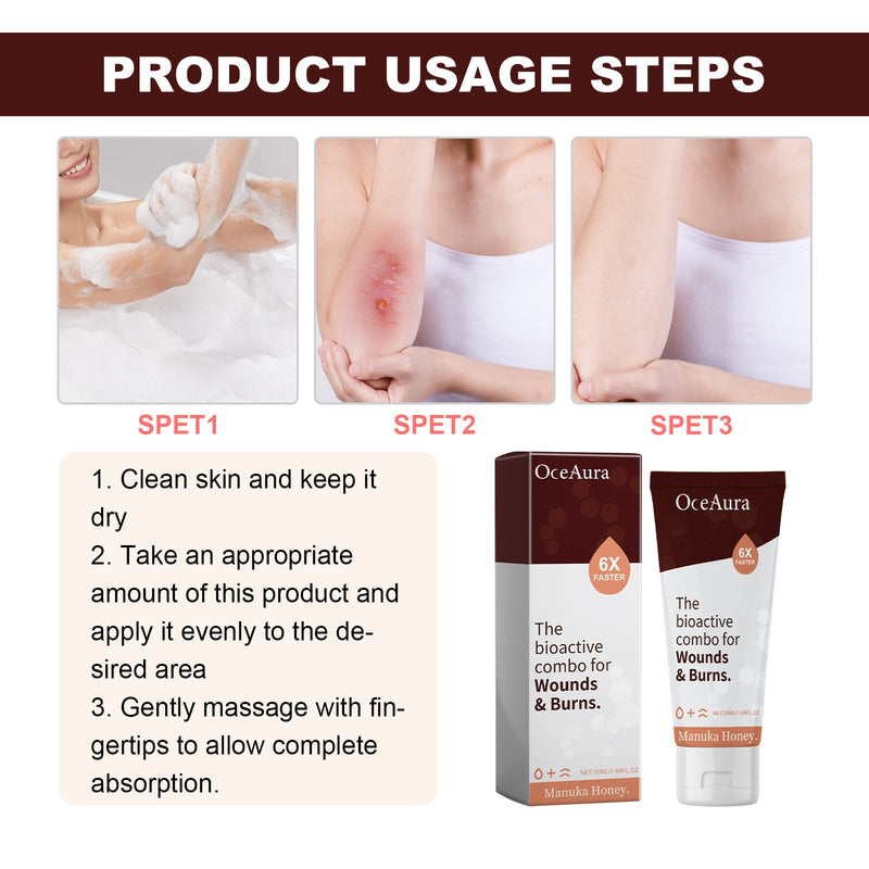 The Bioactive Combo For Wounds& Burns, Alleviate The Brotherhood Of Itchy Skin Redness Itching Repair Body Care Cream