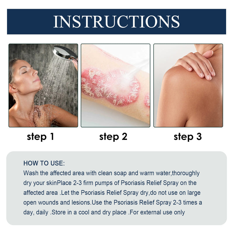 South Moon Psoriasis Relief Spray, Relieve Skin, Hands And Feet Redness Peeling Itch Repair External Care