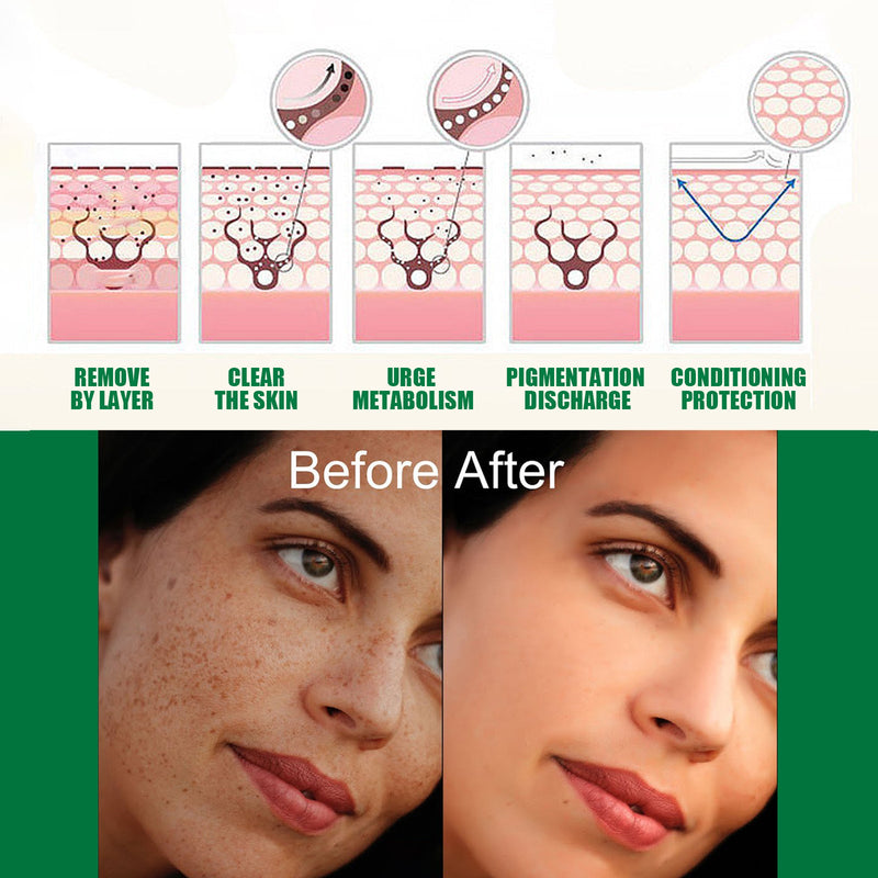 EELHOE Dark Spot Correcting Glow Serum - Fades Freckles & Melanin, Repair Care