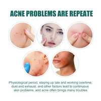 EELHOE Star Acne Patch Gentle Cleansing Lighten Acne Soothing Skin Acne Patch Facial Cleansing Treatment