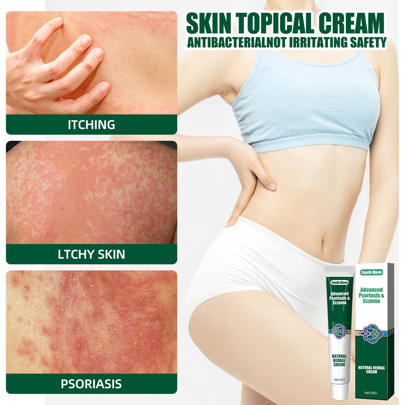 Wet Search Herbal Cream, Skin Cream Moisturizes, Hydrates And Reduces Itching Herbal Cream