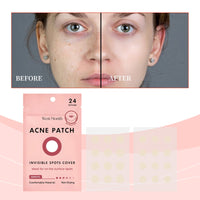 Invisible Acne Patch, Gentle Cleansing Facial Skin Moisturizing Acne Skin Portable Patch
