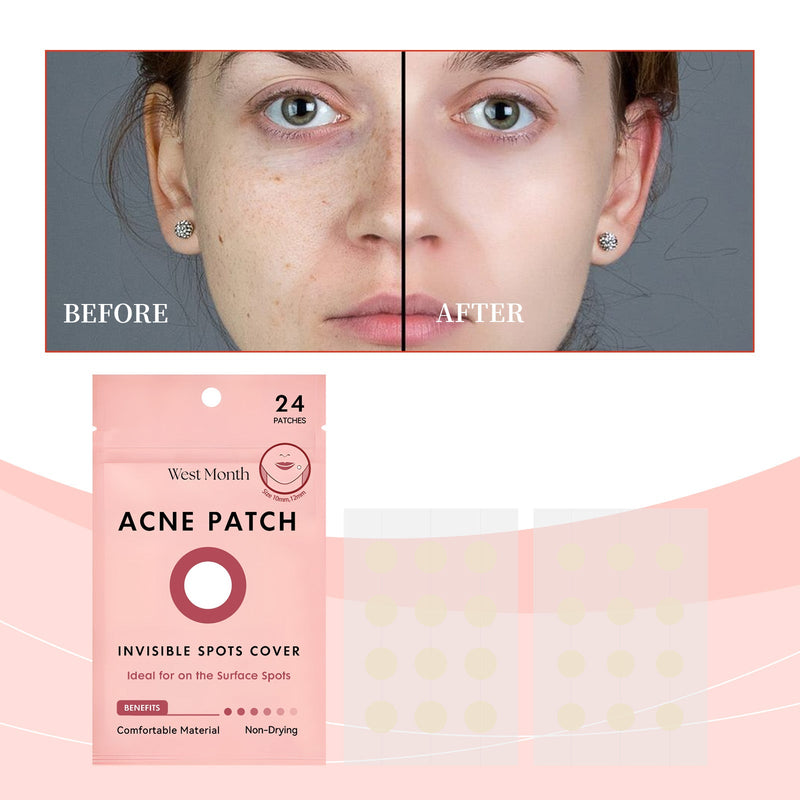 Invisible Acne Patch, Gentle Cleansing Facial Skin Moisturizing Acne Skin Portable Patch