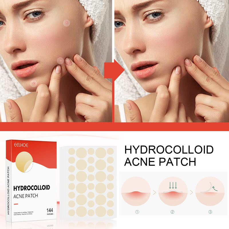 EELHOE Hydrocolloid Acne Patch Face Invisible Makeup Closed Mouth Acne Clear Acne Waterproof Breathable Facial Treatment
