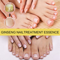 EELHOE Ginseng Nail Essential Oil Grey Nail Thickening Nail Repair Brightening Nail Removing Soft Nail Moisturizing Essence