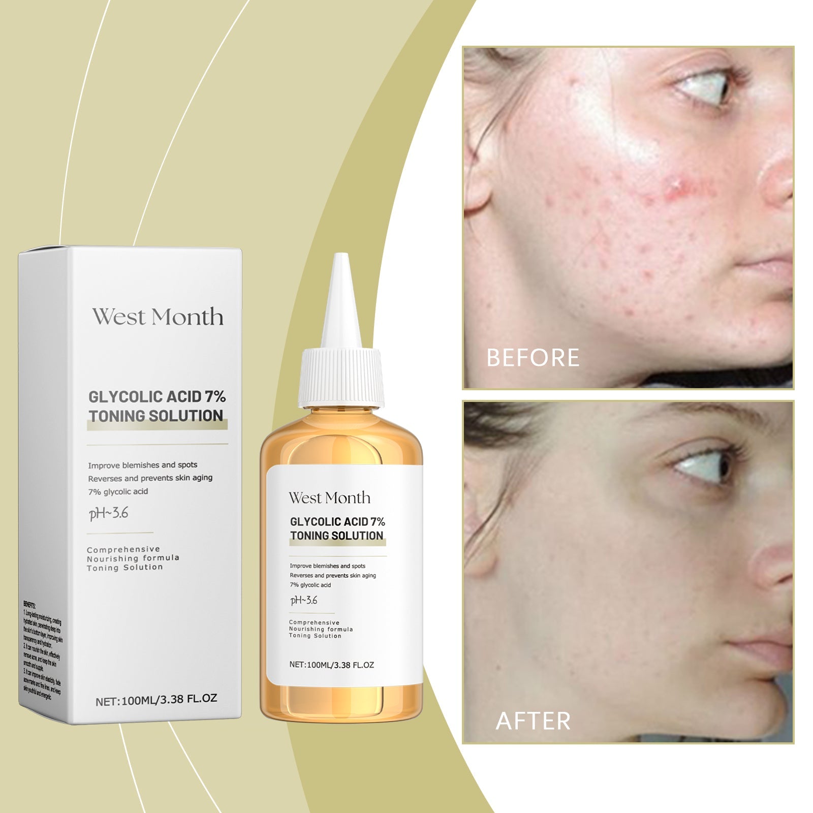 West&Month Moisturizing Toner Gently Cleans Skin From Acne, Moisturizes And Hydrates Refreshing And Moisturizing Toner
